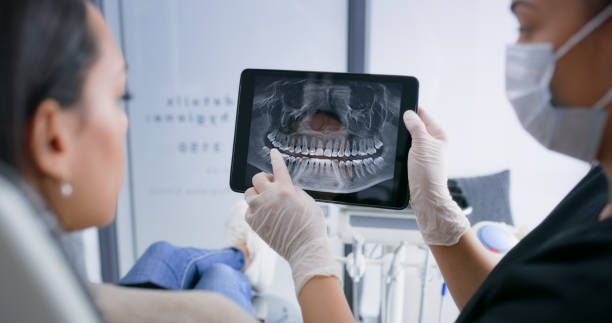 Licensed Dental Implants service in Marion, WI - Smile Center Dentistry