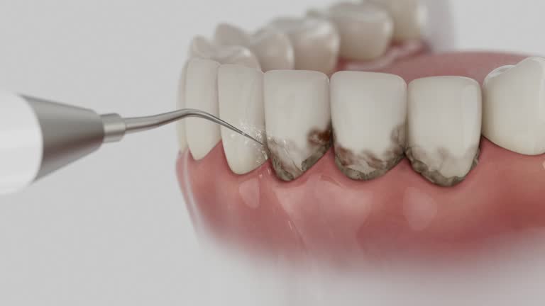 Reliable Dental Implants contractor in Marion, WI by Smile Center Dentistry